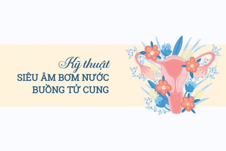 Siêu âm bơm nước buồng tử cung