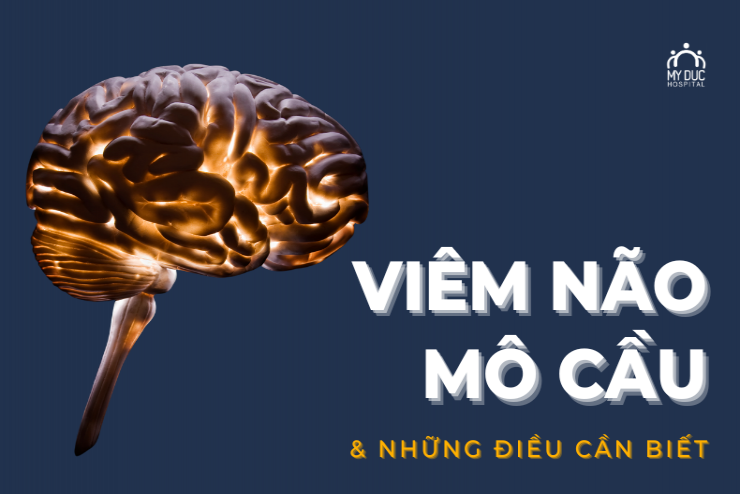 Viêm não mô cầu và những điều cần biết